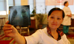 Радиоклиника: "Кургак учукка каршы күрөшүү кандай жыйынтыкты берүүдө?"