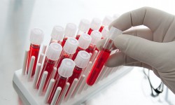 АКШнын окумуштуулары кандагы рак оорусун айыктыруу ыкмасын иштеп чыгышты