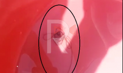 Элдик репортер: Байтик айылынын тургундары ичкен суудан курт чыгууда