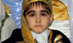 Кирпиги 4.3 сантиметрге жеткен бала