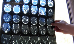 Бишкекте мыкаачылык менен сабалган бейтаптардын абалы турукташты