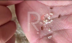 Күрүчтүн ичинен курттар чыкты