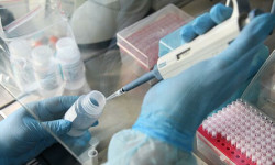 Кытайдан башка өлкөлөрдө коронавирусту жуктургандар 3 жарым миңден ашты