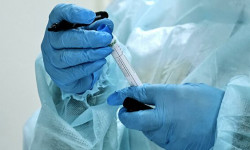 Коронавирусту жуктуруп алгандын баары эле сыркоолоп жатып калбайт