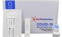 Коронавирусту аныктоочу кошумча 30 миң экспресс-тест сатып алынат