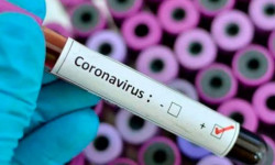 Коронавирус: жаңы учур катталды
