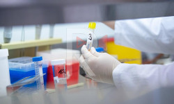 Кыргызстанда коронавирус жуккан 13 жаӊы учур катталды 