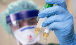 Бүгүн өлкөдө СOVID-19 вирусуна чалдыккан 14 жаӊы учур катталды