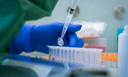 Түркиядан келген 198 жарандан инфекция табылган жок