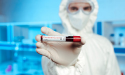 Коронавирус: стационарда 284 жаран дарыланууда