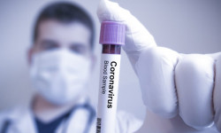 COVID-19 лабораториялык тастыкталган оорулуулар менен байланышта болгон жактардын саны – 3 009