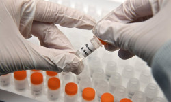 Коронавирус: изилдөөгө келип түшкөн үлгүлөрдүн саны – 51 592