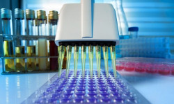 ПЦР анализи үчүн зарыл болгон медициналык каражаттарга тартыштык жок