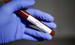 3 медициналык кызматкер коронавирус жуктуруп алды