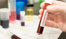 Кыргызстанда COVID-19 вирусун жуктуруунун 895 учуру катталды