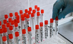 СOVID-19 инфекциясынын жаңы 11 учур катталды