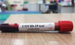 Акыркы сутка ичинде жүргүзүлгөн изилдөөлөр – 2081