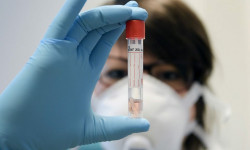 “РСК Банк” ААКнын 2 кызматкери коронавирус инфекциясын жуктурду