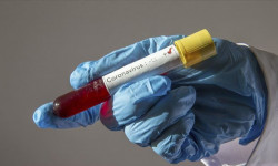 COVID-19: 25 жаңы учур катталды, 8 бейтап айыгып чыкты