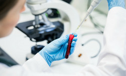 Коронавирус: акыркы сутка ичинде жүргүзүлгөн изилдөөлөр – 1 421