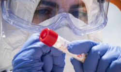 Жалпы коронавирус жуктуруп алгандардын саны өлкө боюнча 1 миң 44 адамга жетти