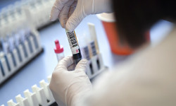 Нарында 14-майга карата  COVID-19 илдети аныкталган 15 жаңы учур катталды