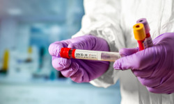 16-майга карата Кыргызстанда коронавирус жуккан 6 жаӊы учур катталды