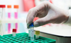 Коронавирус: акыркы сутка ичинде жүргүзүлгөн изилдөөлөр – 2211