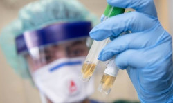 СОVID-19: абал көзөмөлдө