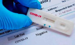 Каза болгон жарандардын бардыгынан COVID-19 вирусуна тест кайталанып алынат