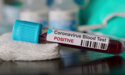 Кыргызстанда 23-майга карата коронавирус жуккан жаңы 15 учур катталды