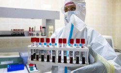 COVID-19: акыркы сутка ичинде жүргүзүлгөн изилдөөлөр –1 294