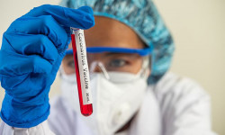 Коронавирус: акыркы сутка ичинде жүргүзүлгөн изилдөөлөр – 1 788