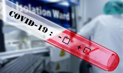 Кыргызстан: СOVID-19 инфекциясынын жаңы 52 учур катталды