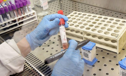 28-майга карата өлкө боюнча СOVID-19 инфекциясынын жаңы 74 учуру катталды