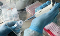 СOVID-19 инфекциясынын жаңы 74 учур катталды