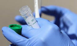 Кыргызстан: СOVID-19 инфекциясынын жаңы 68 учур катталды 