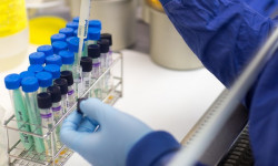 Россиядан келген 11 кош бойлуу келинден коронавирус аныкталды 