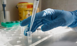 Эпидемиологиялык абал жеңилдей элек