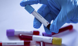 Коронавирус: акыркы сутка ичинде жүргүзүлгөн изилдөөлөр – 2 816 - Кыргызстан жаңылыктары 