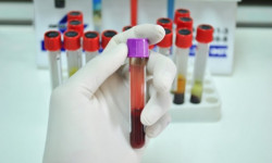 6 медициналык кызматкер коронавирус жуктуруп алды - Кыргызстан жаңылыктары 