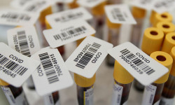 Бүгүнкү күндө COVID-19 вирусунун жаңы 41 учуру катталды