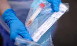 Коронавирус: Акыркы сутка ичинде жүргүзүлгөн изилдөөлөр – 2 278 - Кыргызстан жаңылыктары 