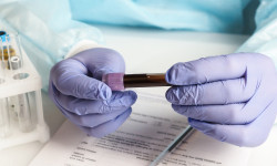 Казакстанда коронавирустан өлгөндөрдүн саны 120 кишиге жетти