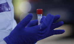 СOVID-19 инфекциясынын жаңы 205 учур катталды - Кыргызстан жаңылыктары 