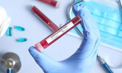 26 медициналык кызматкер коронавирус жуктуруп алды - Кыргызстан жаңылыктары 