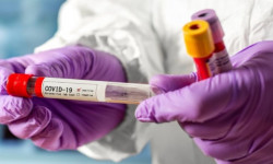 COVID-19: Кыргызстандагы эпидемиологиялык абал - 22.06.2020 - Кыргызстан жаңылыктары