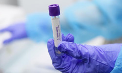 Новостная служба какого телеканала лучше всех освещает ситуацию с коронавирусом в Кыргызстане