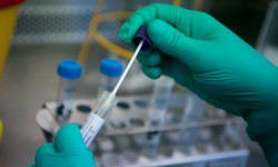 Президентти Москвага коштоп кеткендердин ичинен эки адамдан коронавирус аныкталды 