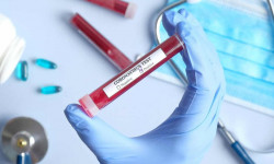 COVID-19: Кыргызстандагы соңку кырдаал - 26.06.2020